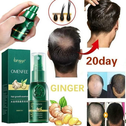 Japanese Hair Growth Spray with Ginger 100ml (Pack of 2)